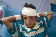  ?? AP PHOTO/HANI MOHAMMED ?? A child injured in a deadly Saudi-led coalition airstrike rests in a hospital in Saada, Yemen, in August. Airstrikes by Saudi Arabia and its allies in Yemen are on a pace to kill more civilians in 2018 than last year despite U.S. claims the coalition is working to prevent such bloodshed.