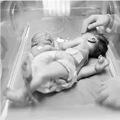  ??  ?? File photo shows the one-day-old Palestinia­n conjoined twins in an incubator at the nursery at al-Shifa Hospital in Gaza City. — AFP photo