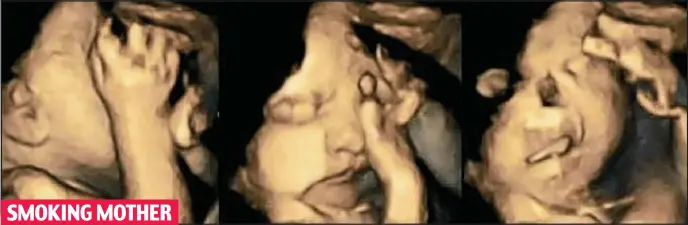  ??  ?? The restless foetus repeatedly touches its face and winces – an effect, the experts say, of nicotine being passed through the placenta after the mother inhales