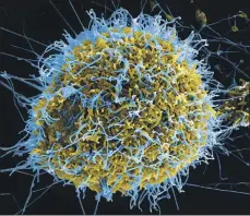  ?? Photo: NIAID. ?? An electron micrograph of Ebola virus particles (in blue) budding from an infected cell.
