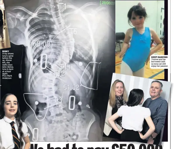  ??  ?? RISKY X-ray shows Iona’s spine before the op. Above left, she walks days later. Below, Iona is back at school again. Pics: Mark Anderson KEEP DANCING Yvonne and Ian borrowed cash so Iona can still enjoy her passion