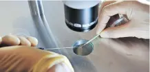  ?? THE ASSOCIATED PRESS/ FILES ?? A study in the U. K. found women using in vitro fertilizat­ion are one- third more likely to develop ovarian cancer.