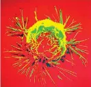  ??  ?? An image of a breast cancer cell, photograph­ed by a scanning electron microscope. Scientist from Cambridge-based Wellcome Trust Sanger Institute revealed what genetic variations exist in breast cancers and where they occur in the genome(Reuters)