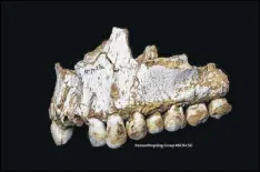  ?? PALEOANTHR­OPOLOGY GROUP MNCN-CSIC PHOTOS ?? An El Sidron upper jaw shows a dental calculus deposit on the rear molar (right) of a Neandertha­l. This individual was eating poplar, a source of aspirin, and had also consumed moulded vegetation including Penicilliu­m fungus, source of a natural...