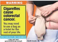  ?? THE CANADIAN PRESS/HO/HEALTH CANADA ?? The federal government is testing graphic new warnings like this one for cigarette packages.