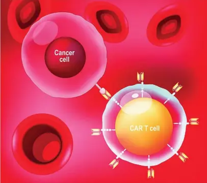  ?? DREAMSTIME ?? Los científico­s investigan estrategia­s CAR-T alogénicas con células T de donantes