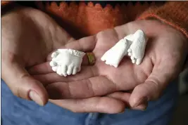  ?? THOMAS PEIPERT — THE ASSOCIATED PRESS ?? Christina Taylor holds plaster casts of her baby's hands and feet at her home in Littleton, Colo., on Wednesday. Taylor chose to get an abortion when she found out after 20weeks that her baby had no kidneys or bladder.