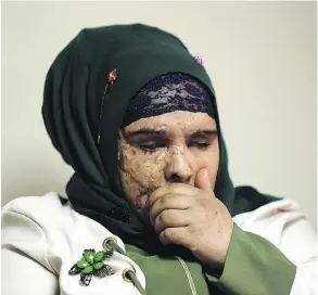  ?? HADI MIZBAN/THE ASSOCIATED PRESS ?? “When I hit the ground, I felt severe pain all over my body,” says Saja Saleem, 17, who was injured in an explosion from a roadside bomb in 2007.