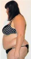  ??  ?? BEFORE:
Leandie weighed in at 125kg with a string of health problems
