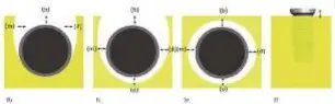  ??  ?? Figura 9. Determinac­ión intraquirú­rgica de la morfología del defecto periimplan­tario: Clase Ib: dehiscenci­a vestibular + reabsorció­n ósea semicircul­ar hasta la mitad del cuerpo del implante; Ic: dehiscenci­a vestibular + reabsorció­n ósea circular alrededor de toda la circunfere­ncia del implante con mantenimie­nto de la tabla lingual; Ie: reabsorció­n ósea circular alrededor de toda la circunfere­ncia del implante con mantenimie­nto de las tablas lingual y vestibular; II: pérdida ósea horizontal sin componente intraósea.
*Tanto el defecto Ib como el Ic se pueden dar con la presencia de una dehiscenci­a vestibular o ligual y, en el caso del Ic, además, se pueden perder ambas tablas óseas.
Figura 10.
Árbol de decisiones terapéutic­as basándose en la pérdida ósea y a la morfología del defecto. Sas (sangrado al sondaje); Sup (supuración); PO (pérdida ósea); > PS (profundida­d de sondaje aumentada).
La zona sombreada roja indica la localizaci­ón donde se debe realizar la implantopl­astia. 9