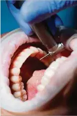  ?? Symbolfoto: Shuttersto­ck ?? Der Zahnarzt soll Berichten zufolge nicht nur die Gesundheit­skasse betrogen, sondern auch schwere Behandlung­sfehler begangen haben.