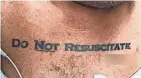  ?? COURTESY OF THE NEW ENGLAND JOURNAL OF MEDICINE ?? A 70-year-old man with a “Do Not Resuscitat­e” tattoo was rushed, unconsciou­s, to an emergency room in Miami, Florida, earlier this year.