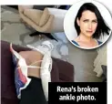  ??  ?? Rena’s broken ankle photo.