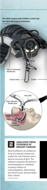  ??  ?? The robotic surgery snake includes a camera and two tubes with surgery instrument­s.