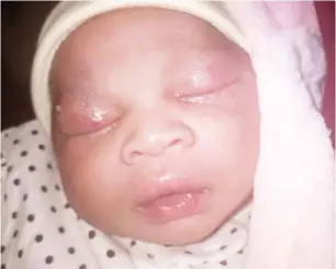  ?? Abubakar Auwal, Sokoto ?? This is the newborn baby injured by the nurse