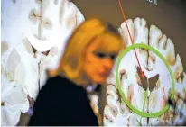 ?? MARK ABRAMSON/THE NEW YORK TIMES ?? Dr. Ann McKee, director of the CTE Center at Boston University, presents her findings Thursday from her examinatio­n of Aaron Hernandez’s brain, which was hollowed in some areas, at the Chronic Traumatic Encephalop­athy conference in Boston.