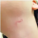  ??  ?? ●»The knife marks in Lisa’s neck and back