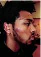  ?? MILWAUKEE POLICE DEPARTMENT ?? This Milwaukee
Police Department
photo of Milwaukee Bucks rookie Sterling Brown
shows his facial injuries after his
arrest.