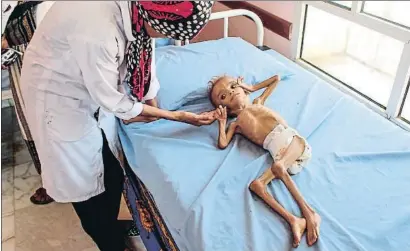  ?? ESSA AHMED / AFP ?? Este niño desnutrido luchaba ayer por su vida en un hospital del norte de Yemen