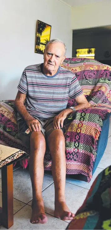  ?? Picture: JUSTIN KENNEDY ?? David Rowland, 78, got two new titanium knees for $25,000 in Thailand