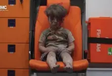 ?? THE ASSOCIATED PRESS FILE PHOTO ?? Omran Daqneesh after surviving an attack in Aleppo, Syria last August.