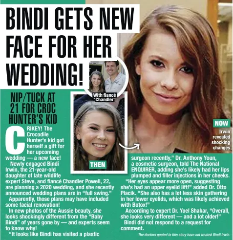  ??  ?? With fiancé Chandler
Irwin revealed shocking changes THEN