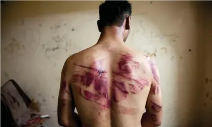  ??  ?? A Syrian man shows marks of torture after he was released from regime forces in Aleppo in 2012. Photograph: AFP/Getty Images