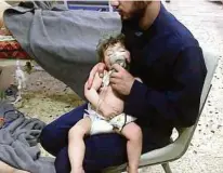  ??  ?? Das AssadRegim­e wurde wiedermitd­em Einsatz von Chemiewaff­en konfrontie­rt. Die Opfer sind oft Kinder