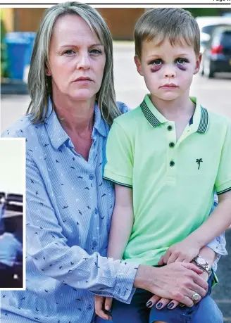  ??  ?? Distraught: Michelle Butt and her son Harry, who suffered two black eyes