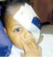  ?? CONTRIBUTE­D ?? Nurse Melesa Neil’s daughter, who was injured when bleach was accidental­ly spilled in her eye at Victoria Jubilee Hospital.