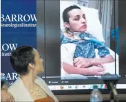  ??  ?? Jovanna Calzadilla­s watches a video clip of herself in a hospital bed during a news conference on her recovery at the Barrow Neurologic­al Institute in Phoenix.