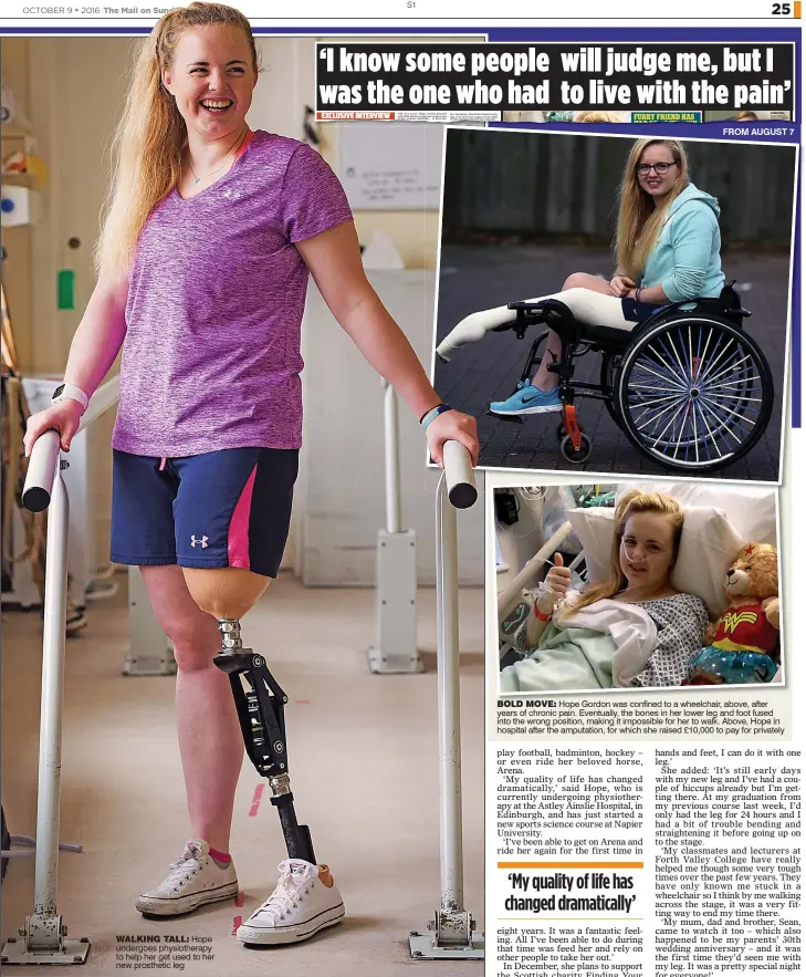  ??  ?? WALKING TALL: Hope undergoes physiother­apy to help her get used to her new prosthetic leg FROM AUGUST 7
BOLD MOVE: Hope Gordon was confined to a wheelchair, above, after years of chronic pain. Eventually, the bones in her lower leg and foot fused into...