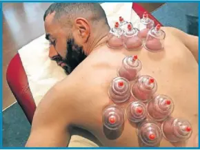  ??  ?? Benzema ha mostrado en sus redes sociales su trabajo junto a su entrenador personal y los efectos en su espalda del ‘cupping’.