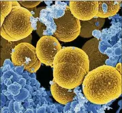  ?? NATIONAL INSTITUTE OF ALLERGY AND INFECTIOUS DISEASES ?? A digitally colorized microscope image shows Staphyloco­ccus aureus bacteria in yellow. Research found protective bacteria in healthy skin produce natural antibiotic­s that can guard against disease-causing staph.