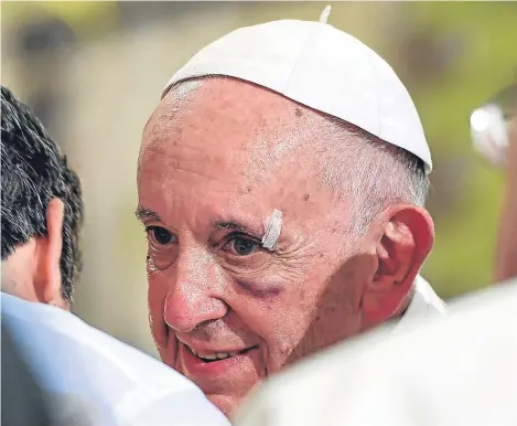  ??  ?? POPE Francis suffered a black eye after hitting his head on the so-called popemobile when his vehicle stopped suddenly.
The pontiff, 80, was met by hundreds of well-wishers in Cartagena, Colombia, on the last day of his visit to the south American...