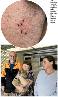  ?? ?? Above: The Stevensons with neighbour Rachel Dittmer, right.
The puncture wounds on Dave’s leg have been causing him pain. He believes the dog was a pitbull.