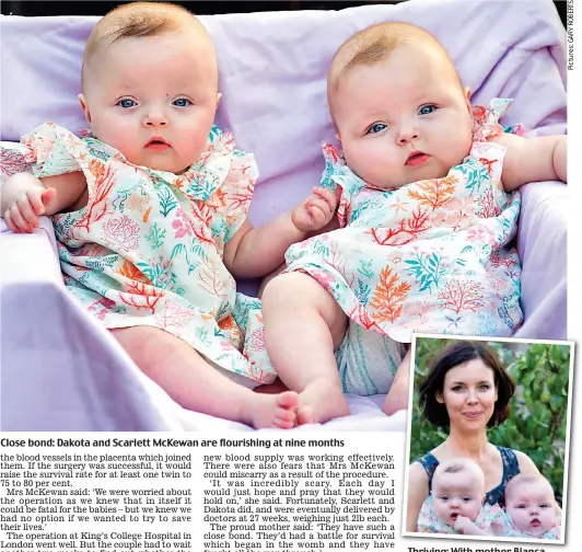  ??  ?? Close bond: Dakota and Scarlett McKewan are flourishin­g at nine months Thriving: With mother Bianca