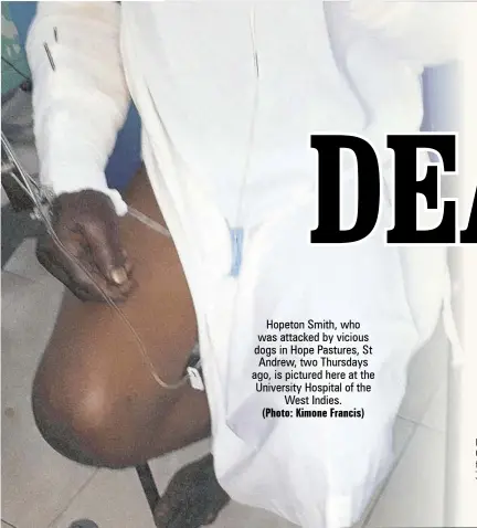  ?? (Photo: Kimone Francis) ?? Hopeton Smith, who was attacked by vicious dogs in Hope Pastures, St Andrew, two Thursdays ago, is pictured here at the University Hospital of the West Indies.