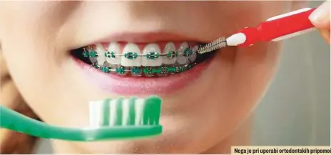  ?? FOTO: VOYAGERIX/GETTY IMAGES ?? Nega je pri uporabi ortodontsk­ih pripomočko­v izjemno pomembna.