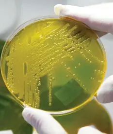  ?? Foto: Matthias Bein, dpa ?? In der Petrischal­e zu Forschungs­zwecken gezüchtete multiresis­tente Keime: Drei Viertel aller Infektione­n passieren in Krankenhäu­sern.