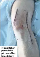  ??  ?? &gt; Dan Baker posted this picture of his knee injury