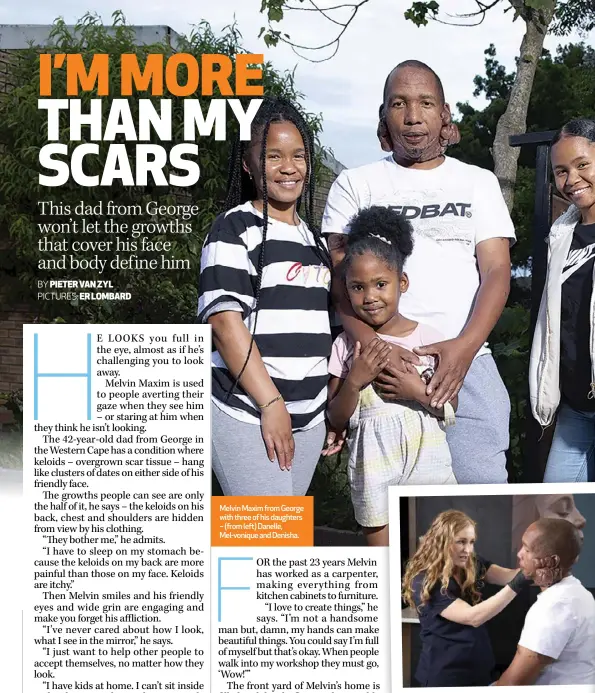  ?? ?? Melvin Maxim from George with three of his daughters – (from left) Danelle, Mel-vonique and Denisha.
ABOVE: Aesthetic practition­er Dr Ansua Steyn, also known as the TV dermatolog­ist Dr Etter, and a George plastic surgeon are going to help Melvin with the keloids on his face. RIGHT: Melvin also has growths on his back and arms.
