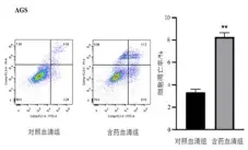  ?? ?? 注：与对照血清组比较，**P<0.01
图8 2组HGC-27、AGS细胞凋亡率比较（x±s）