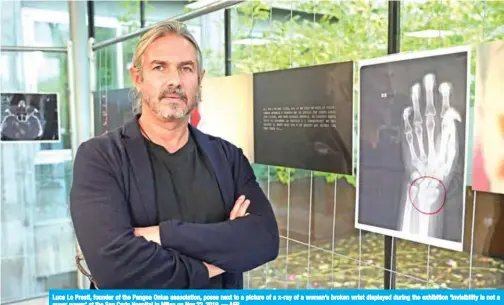  ?? — AFP ?? Luca Lo Presti, founder of the Pangea Onlus associatio­n, poses next to a picture of a x-ray of a woman’s broken wrist displayed during the exhibition ‘Invisibili­ty is not a super power’ at the San Carlo Hospital in Milan on Nov 22, 2019.