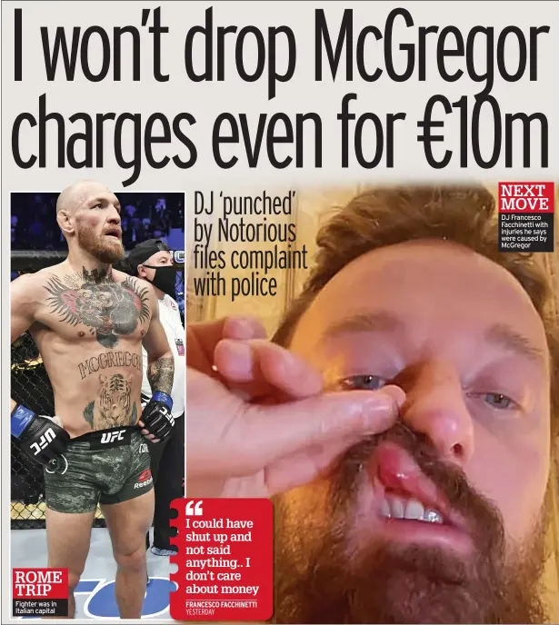  ?? ?? DJ Francesco Facchinett­i with injuries he says were caused by Mcgregor
