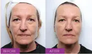  ?? Picture: MY PERFECT FACIAL ?? Scientific: Home facial was designed for clinics