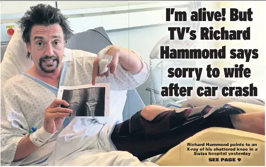  ??  ?? Richard Hammond points to an X-ray of his shattered knee in a Swiss hospital yesterday