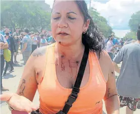  ??  ?? Balas de goma. Una manifestan­te formoseña muestra sus heridas.