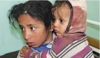  ?? - Reuters file photo ?? BRINK OF STARVATION: A girl holds her brother at a hospital in Saada, Yemen. Overall, 24 million people in Yemen will need humanitari­an assistance in 2019.