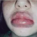  ?? FOTO RR ?? Kylie Jenner Lip Challenge.